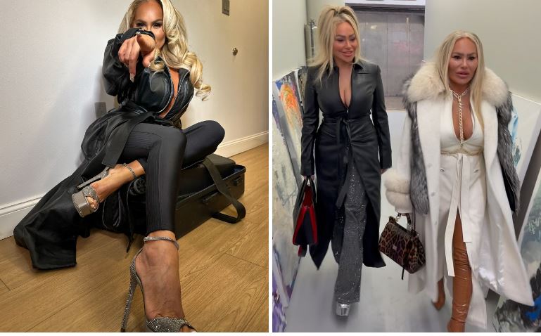 darcey and stacey plastic surgery