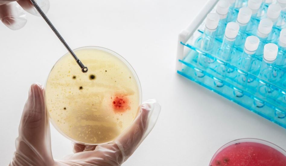 how is sickle cell anemia diagnosed
