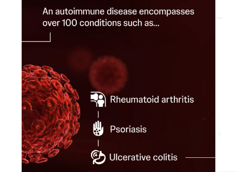 Autoimmune Disease Autoimmune Disease
