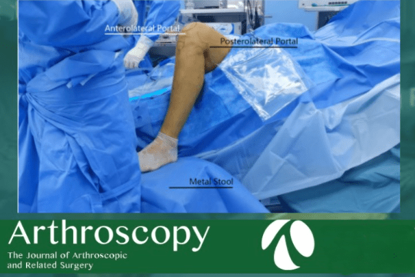 Arthroscopic Knee Surgery Arthroscopic Knee Surgery