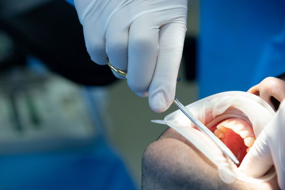 sinus lift surgery